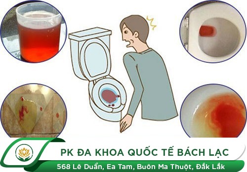 Tiểu Ra Máu Có Thật Sự Nguy Hiểm Không