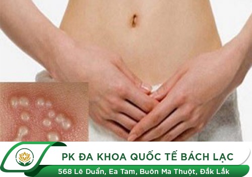 Bệnh Hột Xoài Là Bệnh Gì? Cách Chữa Như Thế Nào?