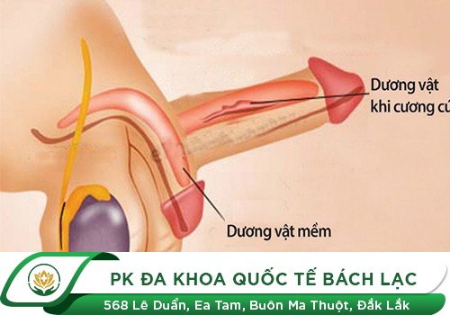 Dương Vật Bị Đau Khi Cương Cứng Dấu Hiệu Bệnh Lý Nguy Hiểm
