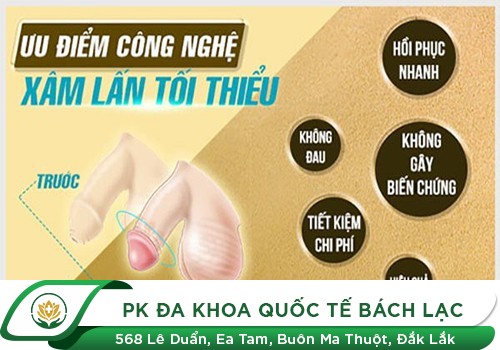 Top 3 Phương Pháp Cắt Bao Quy Đầu Nhanh Chóng - Thẩm Mỹ - An Toàn