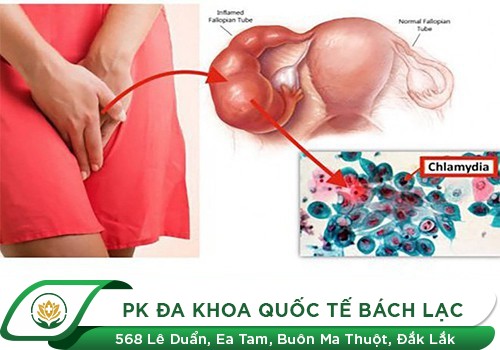 Các Bệnh Viêm Nhiễm Sinh Dục Thường Gặp Ở Nam Và Nữ