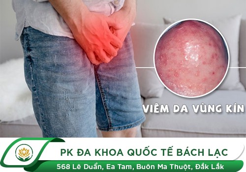 Viêm Da Vùng Kín Nam Và Cách Xử Lý An Toàn