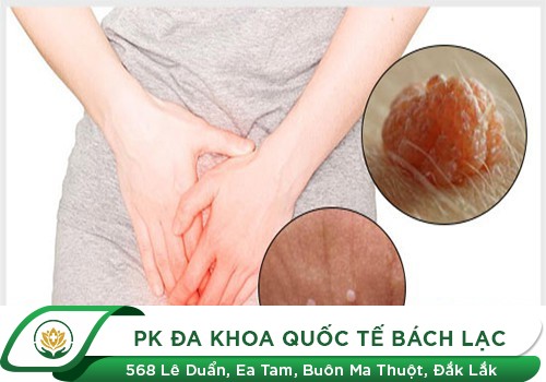 Gai Sinh Dục Ở Nam Giới Có Nguy Hiểm Không?