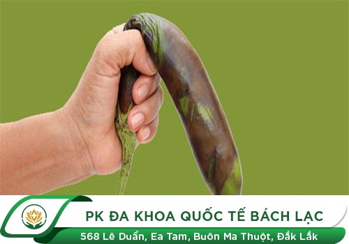 Dương Vật Tím Tái, Bao Quy Đầu Bầm Tím Là Bệnh Gì