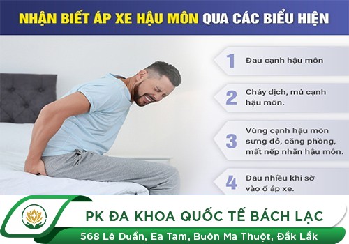 Dấu Hiệu Apxe Hậu Môn Và Cách Hỗ Trợ Điều Trị Apxe Hậu Môn