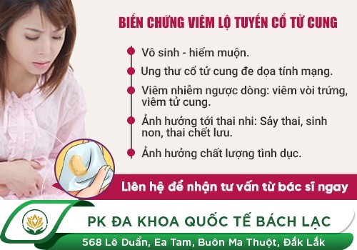 Chi phí điều trị viêm cổ tử cung là bao nhiêu?