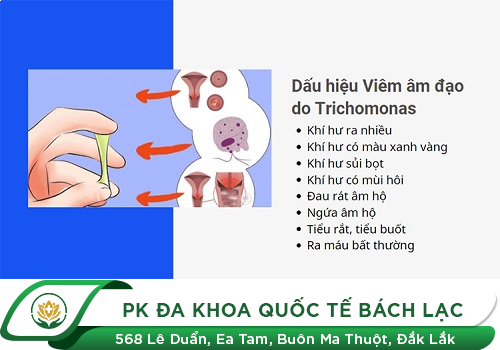Viêm Nhiễm Âm Đạo Do Trichomonas Ở Nữ Giới