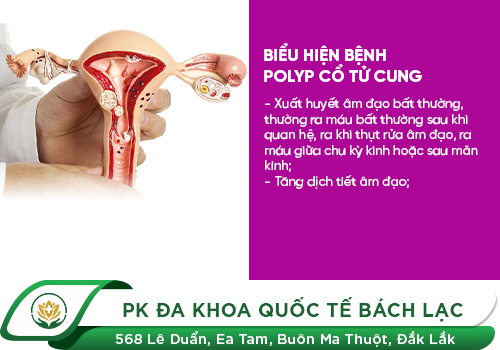 Nguyên Nhân Và Nguy Hại Của Polyp Cổ Tử Cung Đối Với Sức Khỏe Nữ Giới