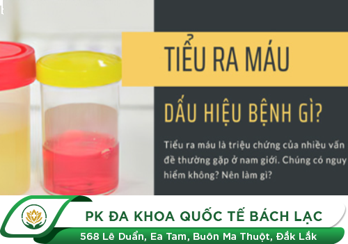 Cách Chữa Tiểu Ra Máu Hiệu Quả Nhất