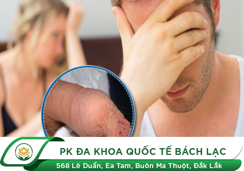 Bao Quy Đầu Chưa Lột Có Quan Hệ Được Không
