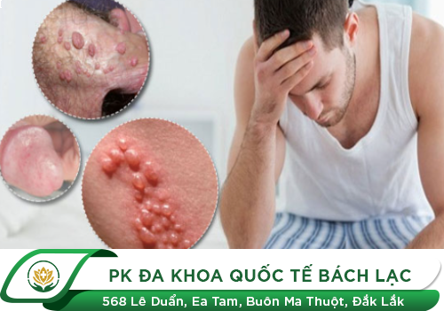 Nguy Hiểm Nổi Mụn Nhọt Ở Dương Vật - Cách Trị Hiệu Quả