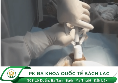 Ưu điểm khi cắt bao quy đầu bằng công nghệ Surkon Hàn Quốc