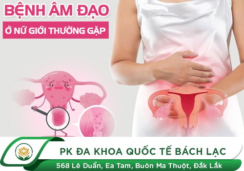 Tổng hợp các bệnh âm đạo nữ giới cần lưu ý