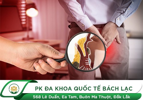 Bệnh trĩ có chữa được không?