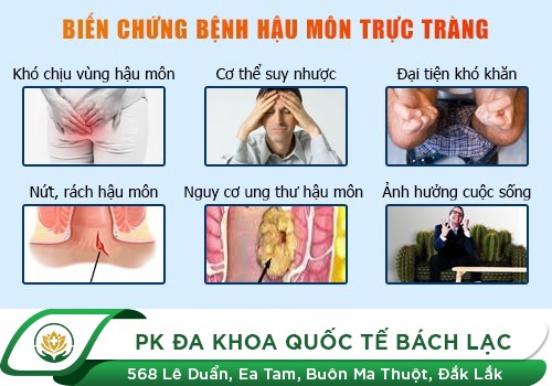 Hậu môn bị chảy máu nhưng không đau do viêm loét trực tràng