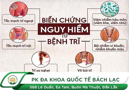 Bệnh Trĩ Có Dễ Dàng Lây Sang Người Thân Không