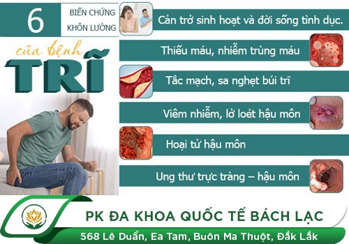 Phẫu Thuật Trĩ Hết Bao Nhiêu Tiền