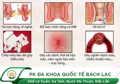 Polyp trực tràng có những biểu hiện gì?