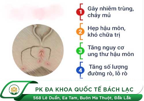 Bệnh mạch lươn có nguy hiểm không?