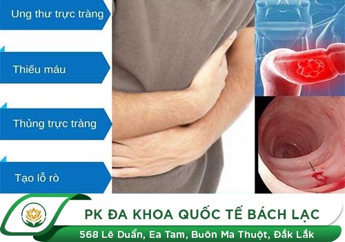 Biến chứng khôn lường từ viêm loét trực tràng