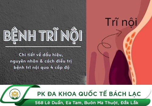 Bệnh Trĩ Nội Nguy Hiểm Thế Nào
