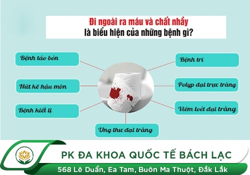Đi cầu ra máu và chất nhầy do táo bón
