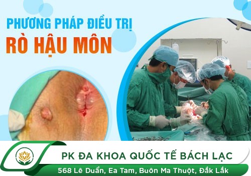 PHƯƠNG PHÁP NÀO CHỮA RÒ HẬU HẬU MÔN TỐT HIỆN NAY?