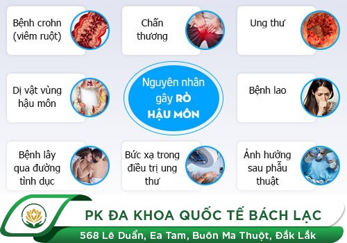  Nguyên nhân nào dẫn đến rò hậu môn?