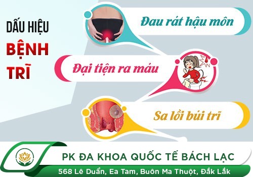 Dấu hiệu nhận biết bệnh trĩ