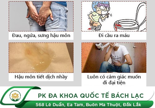 Bệnh trĩ là gì?