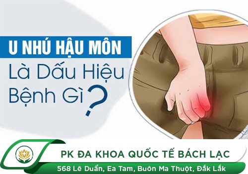 Xuất Hiện U Nhú Ở Hậu Môn Phải Làm Sao