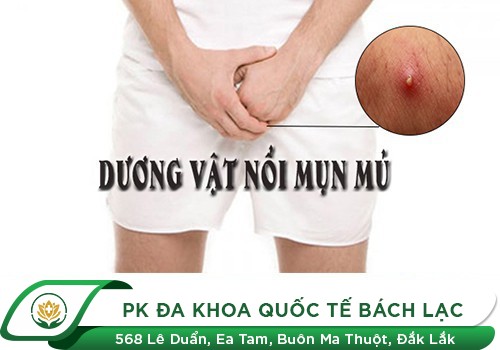 Nổi mụn ở bìu tinh hoàn là dấu hiệu bệnh gì?