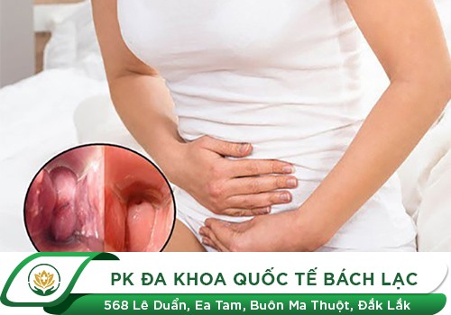 Âm đạo chảy mủ