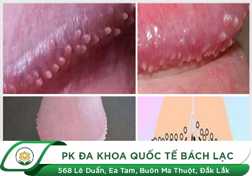 Điểm danh những căn bệnh dễ lây cho cậu nhỏ