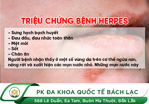 Herpes sinh dục