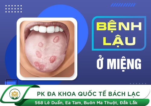  triệu chứng bệnh lậu 