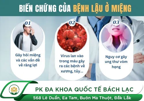 BIỂU HIỆN CỦA BỆNH LẬU Ở MIỆNG