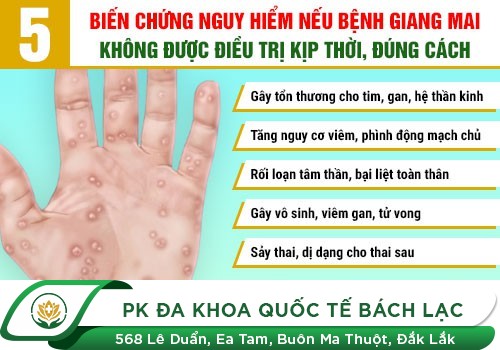 Những bệnh xã hội nguy hiểm thường gặp