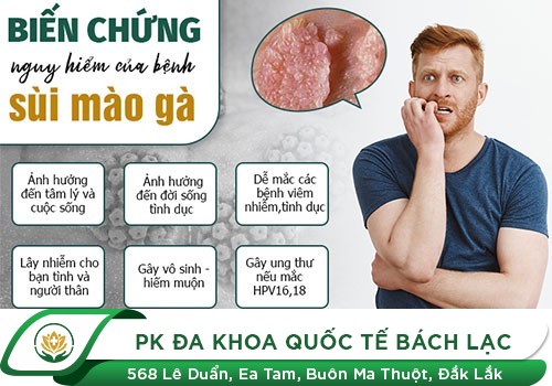 Dương vật lở loét là bệnh gì?