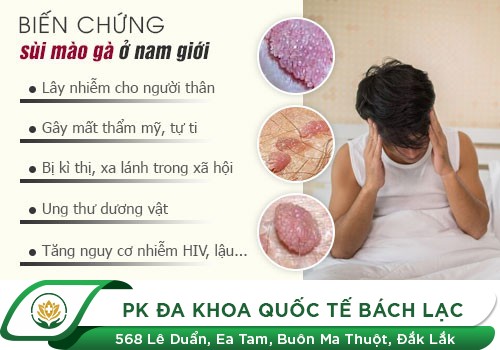 Nổi mụn ở tinh hoàn