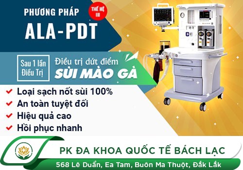 Điều trị bệnh sùi mào gà bằng liệu pháp quang động ALA - PDT