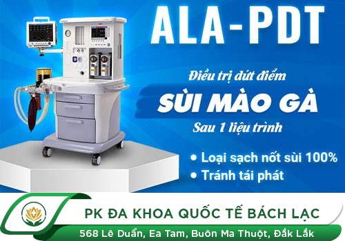 điều trị sùi mào gà ở dương vật