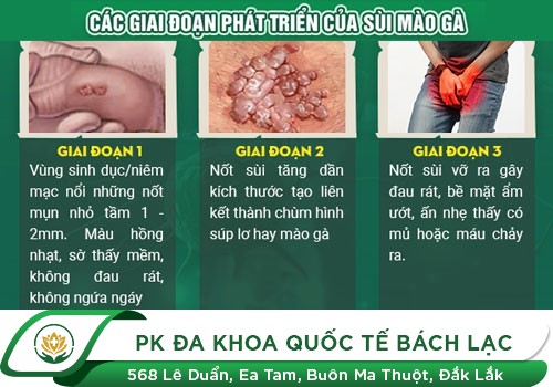 TÁC HẠI CỦA BỆNH SÙI MÀO GÀ