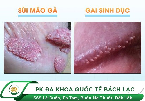 VẬY GAI SINH DỤC CÓ NGUY HIỂM KHÔNG?
