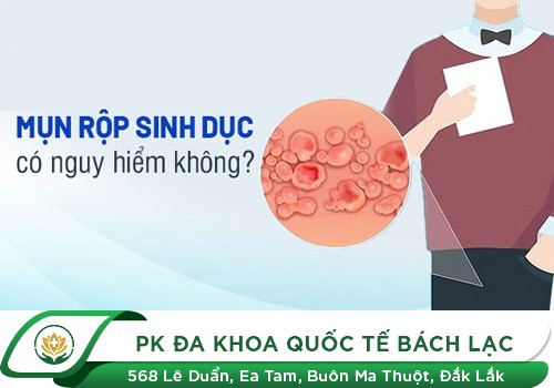 Mụn rộp sinh dục