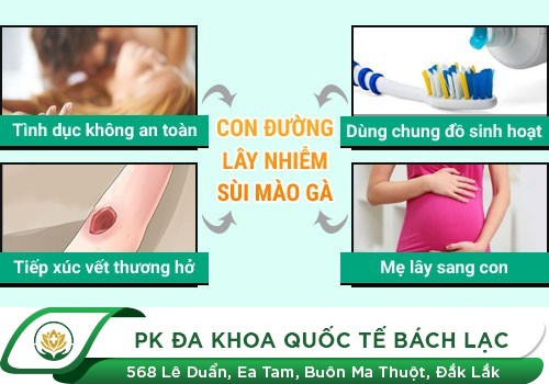 Sùi mào gà ở nam giới