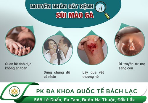 Nguyên nhân gây bệnh sùi mào gà ở nam và nữ giới là gì?