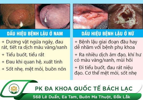  triệu chứng bệnh lậu 