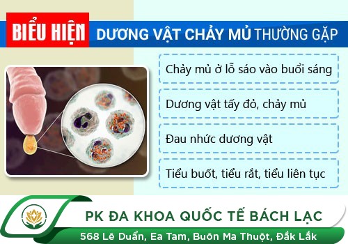 Làm gì khi bị chảy mủ ở bộ phận sinh dục nam?