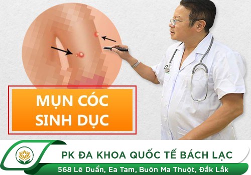 Mụn cóc sinh dục là gì?